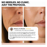 NEDA 30-Night Reset™